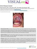 Cover page: Oral Herpes Zoster