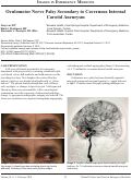Cover page: Oculomotor Nerve Palsy Secondary to Cavernous Internal Carotid Aneurysm