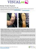 Cover page: Biceps Tendon Rupture