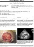 Cover page: Acute Cardiac Air Embolism